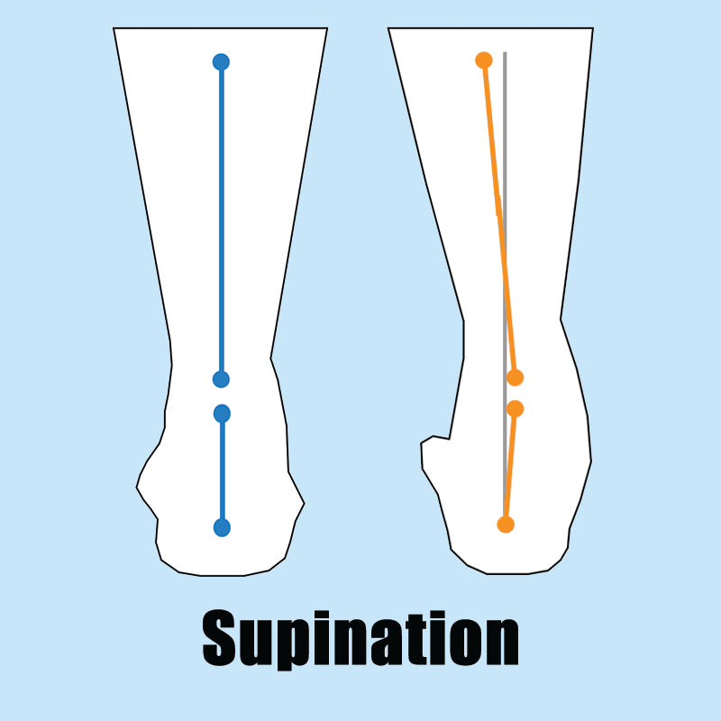 Supination – tagged Brand_Orthaheel – The Insole Store